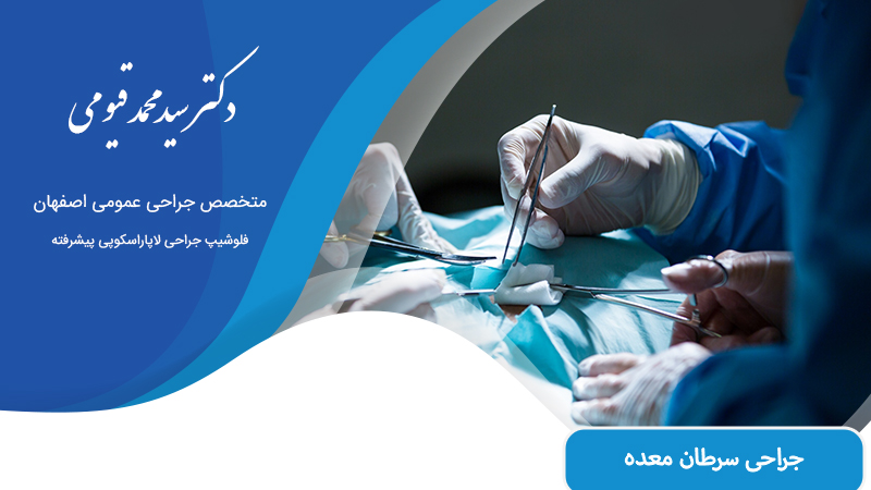 جراحی سرطان معده در اصفهان