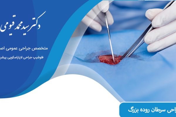 جراحی سرطان روده بزرگ در اصفهان