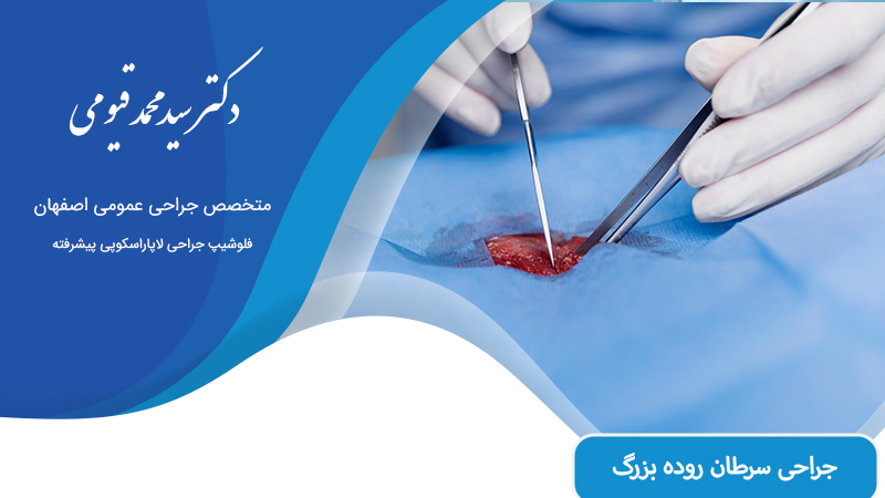 جراحی سرطان روده بزرگ در اصفهان