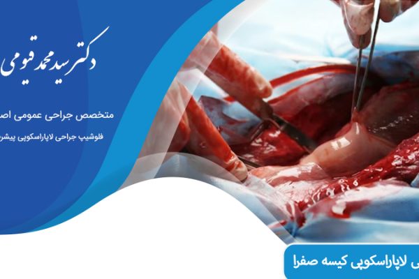 جراحی لاپاراسکوپی کیسه صفرا در اصفهان