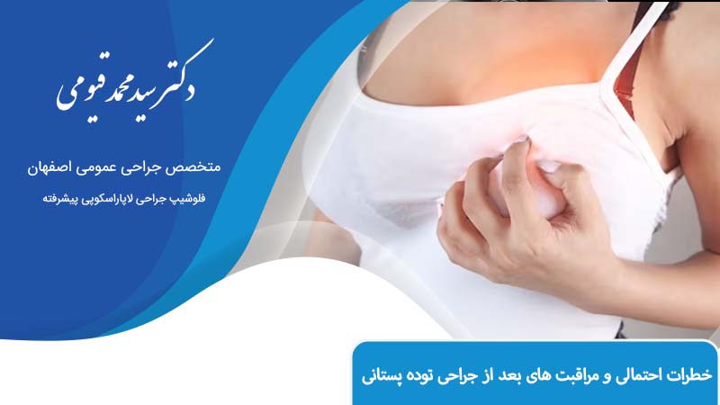 جراحی توده پستانی در اصفهان