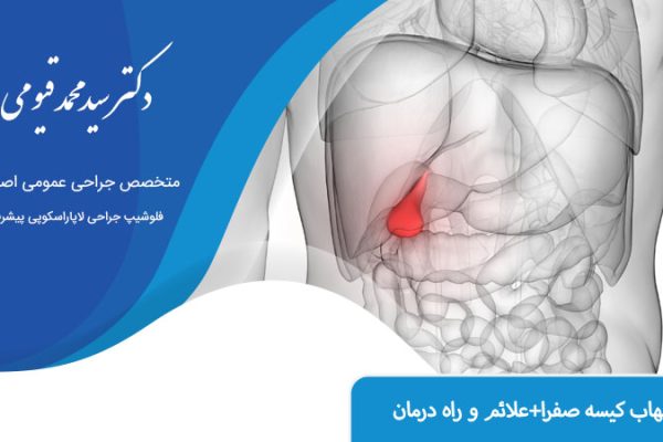 کیسه صفرا