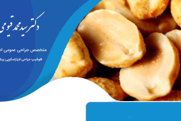 غذاهای مناسب بعد از جراحی چاقی
