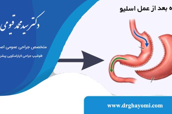 هزینه عمل اسلیو معده