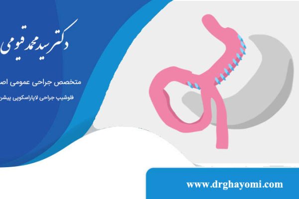 اسلیو ساسی چیست؟