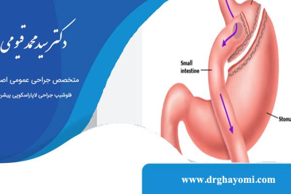 ایا عمل اسلیو عوارض دارد