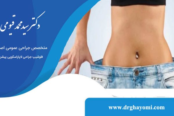 بالن در معده برای لاغری