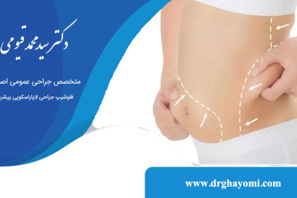 جراحی لیپوماتیک