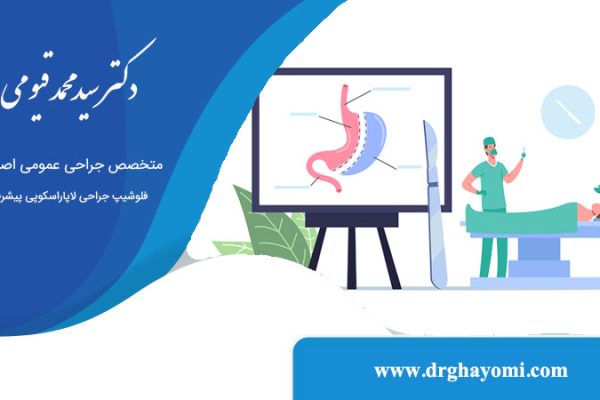اقدامات لازم قبل از عمل اسلیو
