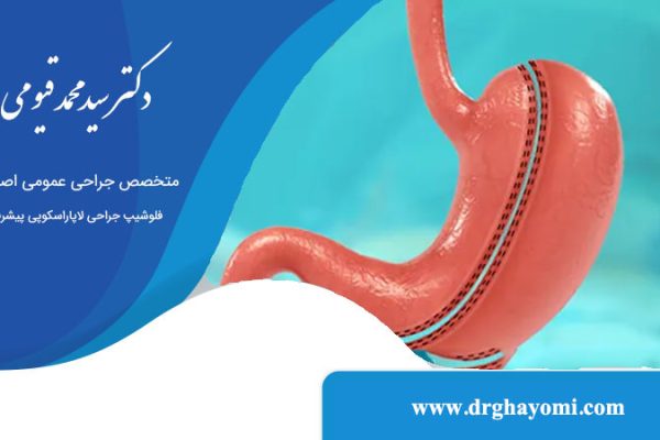 آیا عمل اسلیو عوارض دارد