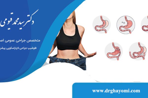 بهترین جراحی برای لاغری