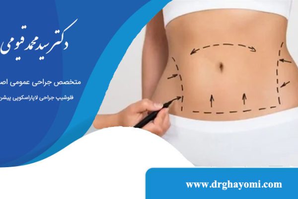 بهترین روش جراحی برای لاغری شکم