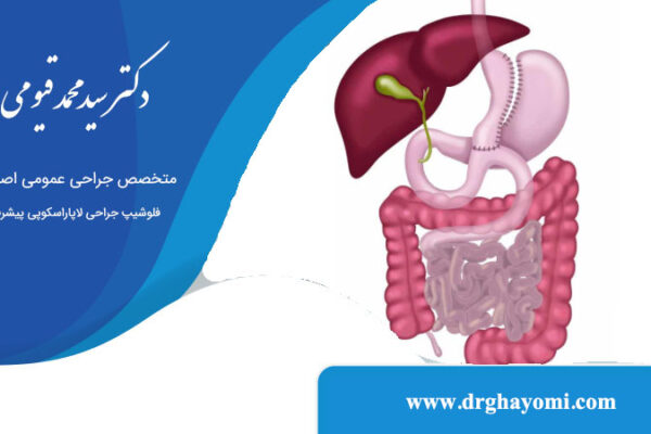 تفاوت بای پس و مینی بای پس معده
