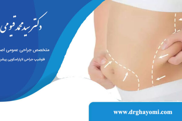 جراحی لیپوماتیک