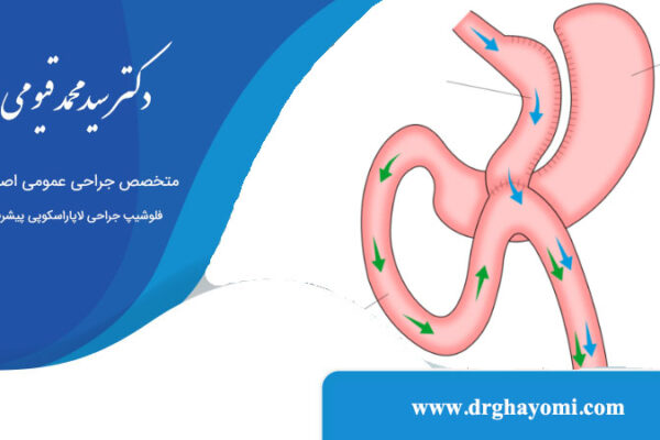 جراحی ساسج