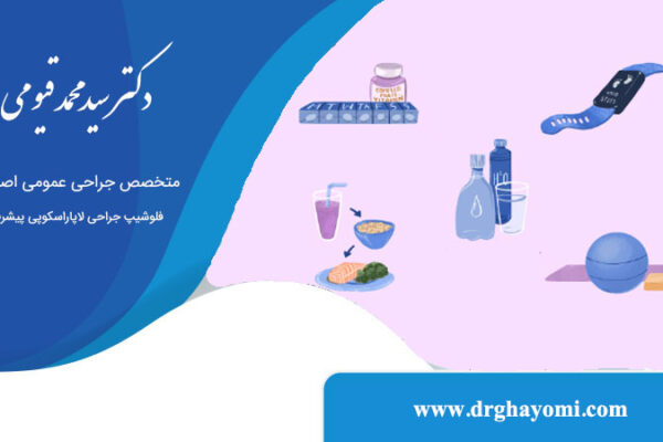دوره نقاهت پس از عمل مینی بایپس معده
