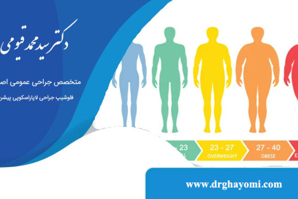 روند کاهش وزن بعد از عمل اسلیو