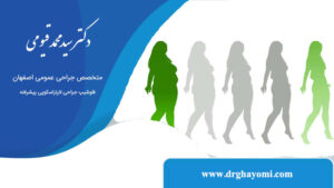 روند کاهش وزن پس از عمل بای‌پس