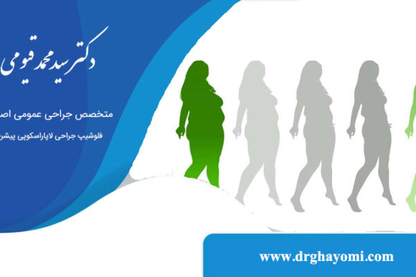 روند کاهش وزن پس از عمل بایپس