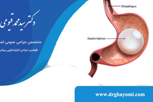 عمل بالن معده چیست