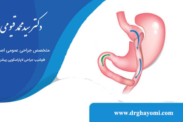 عمل بای پس امگا