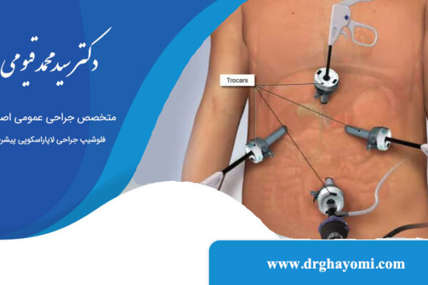 جراحی لاپاراسکوپی کیسه صفرا