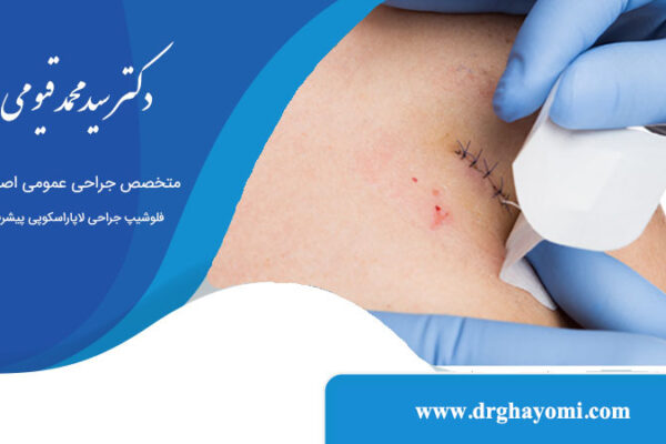 مراقبت از زخم بعد از جراحی عمومی
