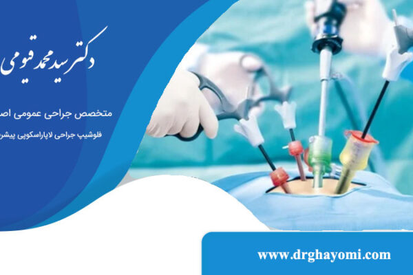 مدت زمان عمل لاپاراسکوپی کیست تخمدان