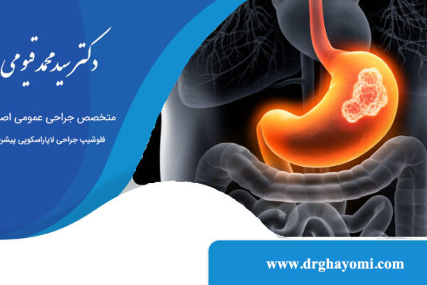 علائم اولیه سرطان معده