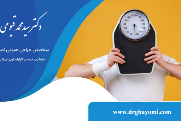 میزان کاهش وزن بعد از اسلیو معده