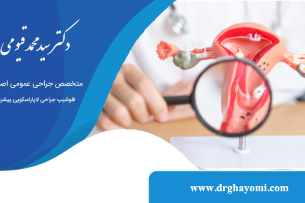 لاپاراسکوپی در درمان چسبندگی رحم