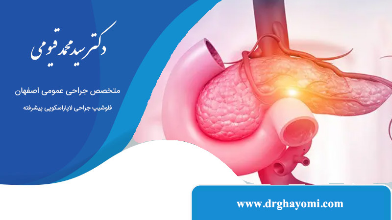 درمان سرطان پانکراس