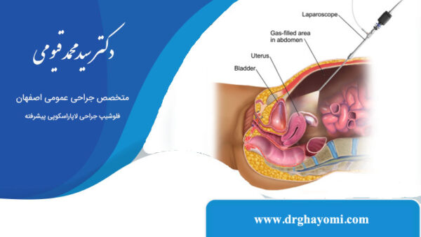 عوارض لاپاراسکوپی روده و معده