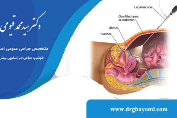 عوارض لاپاراسکوپی روده و معده