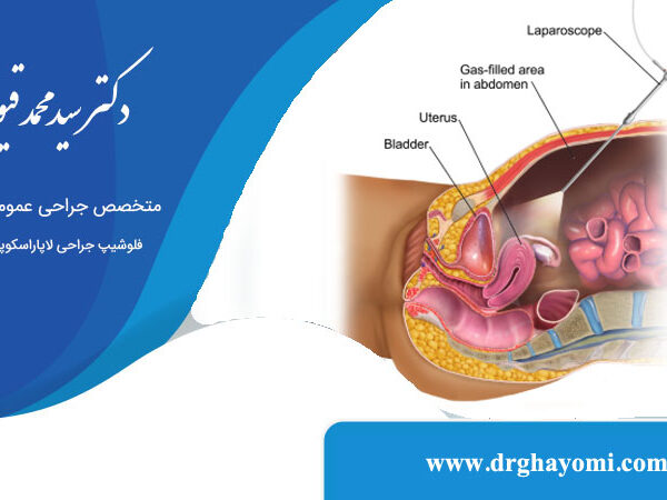 عوارض لاپاراسکوپی روده و معده