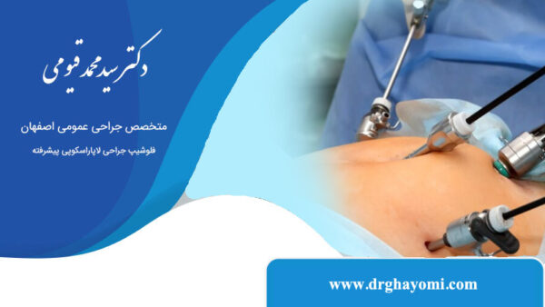 مدت زمان بهبودی پس از لاپاراسکوپی