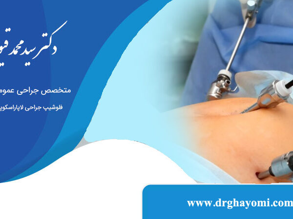 مدت زمان بهبودی پس از لاپاراسکوپی