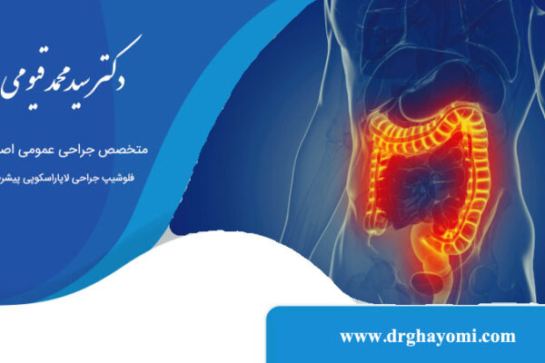 درمان کولیت روده