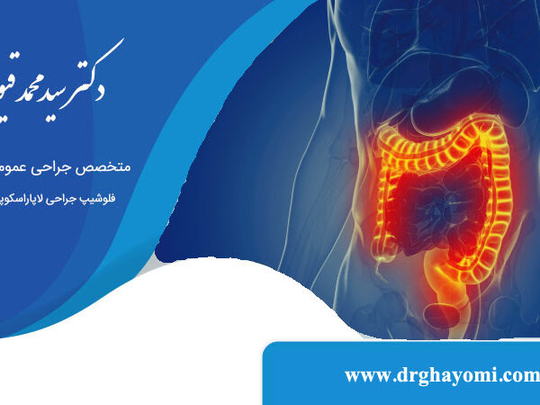 درمان کولیت روده
