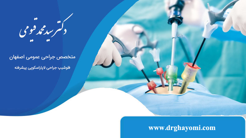 لاپاراسکوپی برای تشخیص سرطان