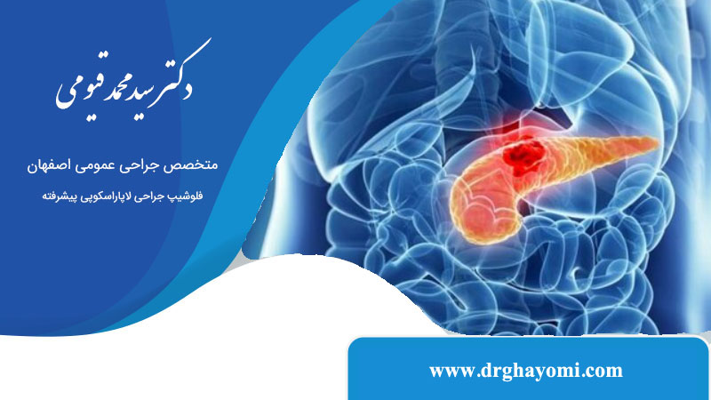 علائم هشدار دهنده سنگ کیسه صفرا