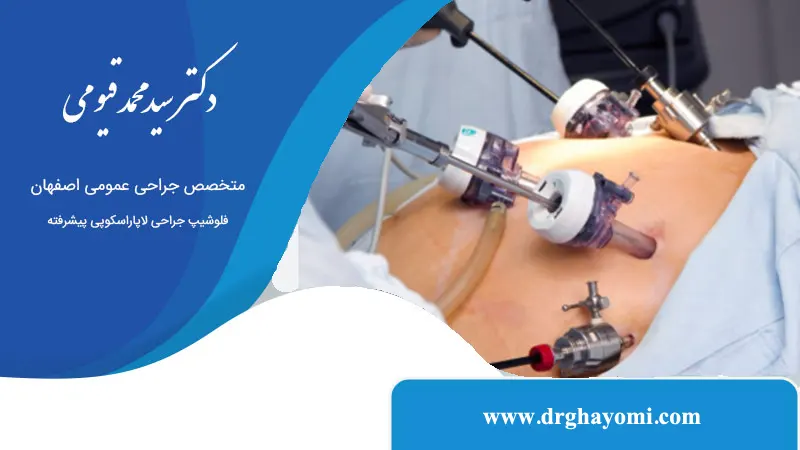 جراحی لاپاراسکوپی در برابر جراحی باز