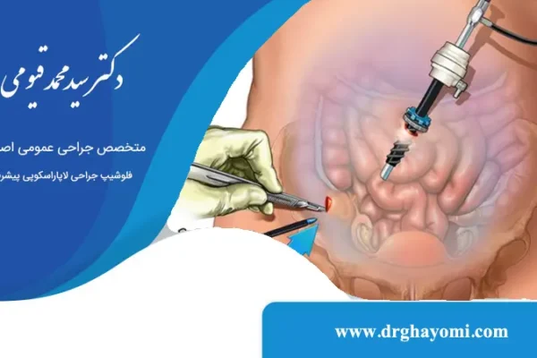 آیا بعد از لاپاراسکوپی میتوان غذا خورد؟