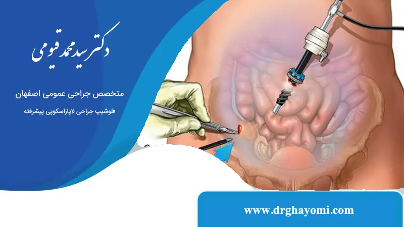آیا بعد از لاپاراسکوپی می‌توان غذا خورد؟