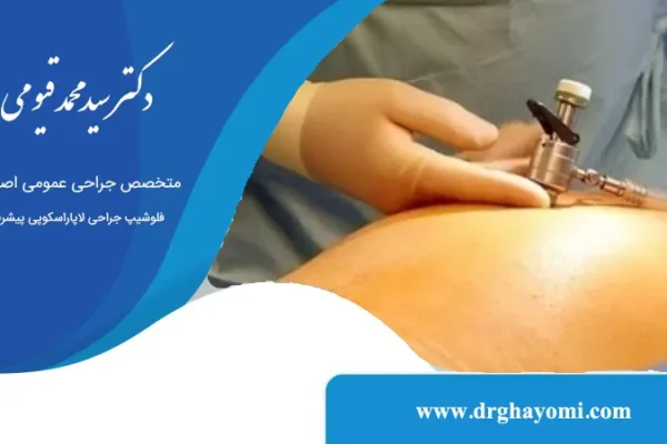 آیا بعد از لاپاراسکوپی میتوان رانندگی کرد؟