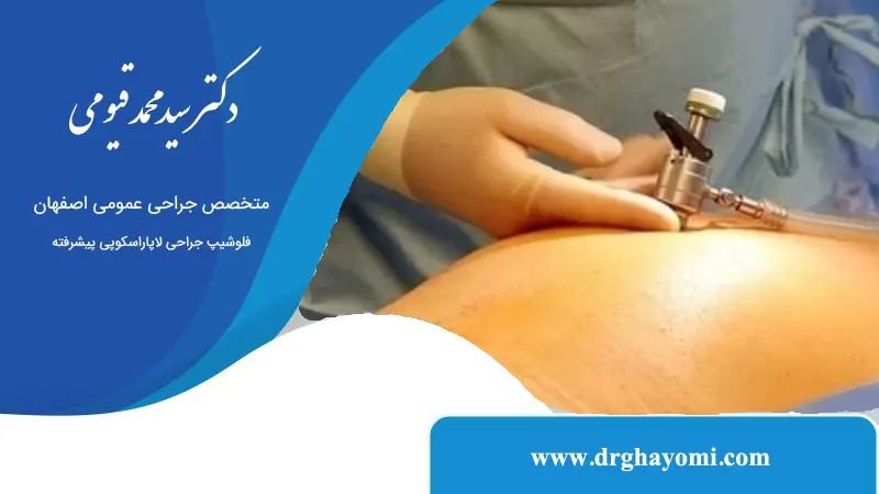 آیا بعد از لاپاراسکوپی می‌توان رانندگی کرد؟