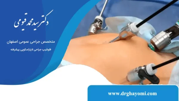 آیا لاپاراسکوپی به بستری طولانی نیاز دارد؟