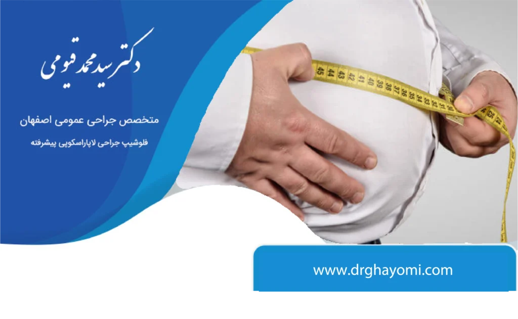 آیا جراحی چاقی دائمی است؟