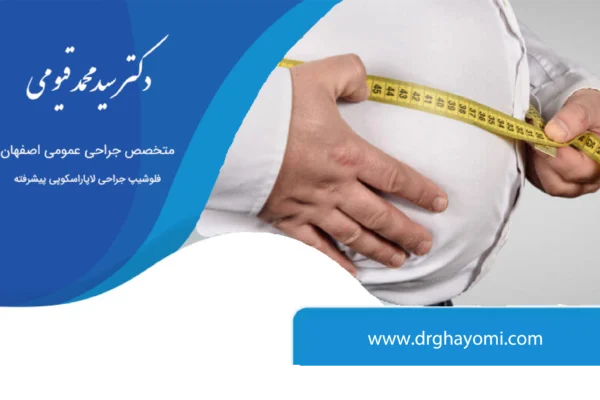 آیا جراحی چاقی دائمی است؟
