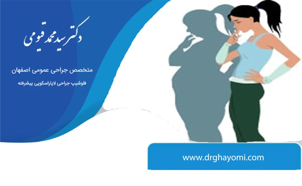 بازگشت وزن بعد از عمل لاغری